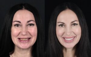 Стоматолог запатентовал методику восстановления зубов за три дня