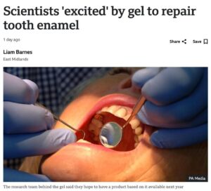 Учёные создали гель для восстановления зубной эмали